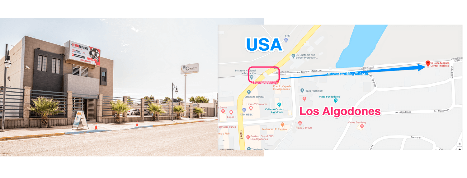 Dr Moguel dental implant clinic los algodones