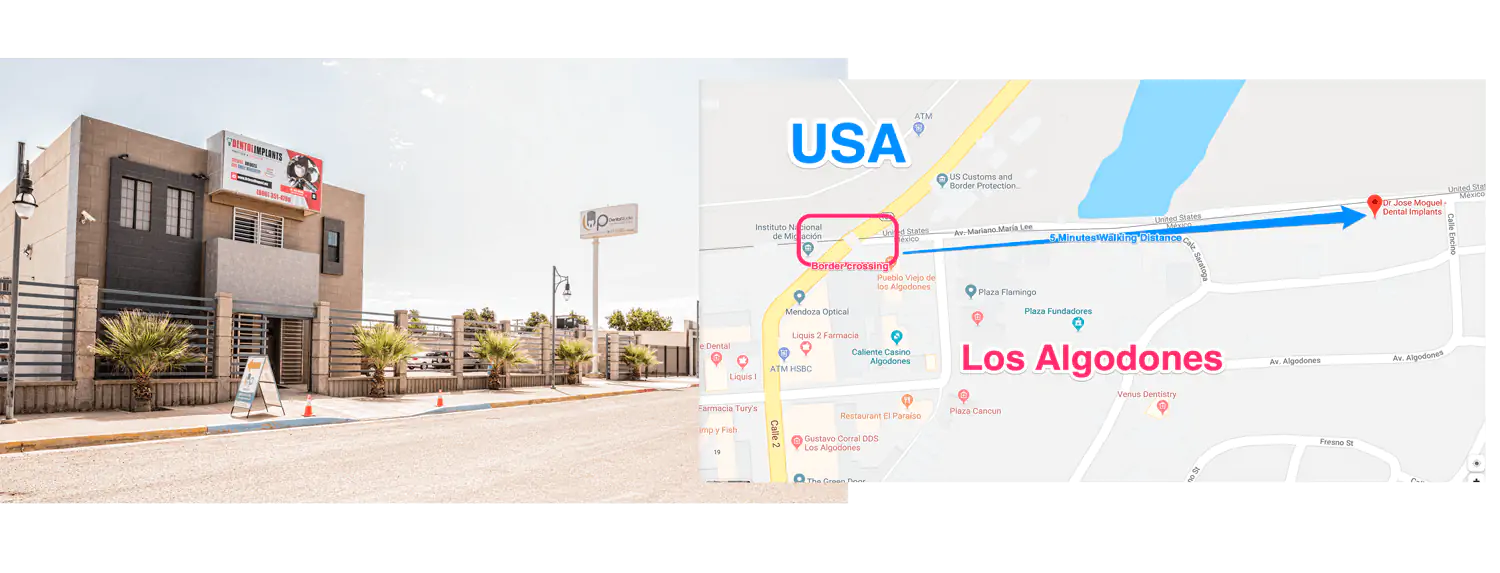 Dr Moguel dental implant clinic los algodones