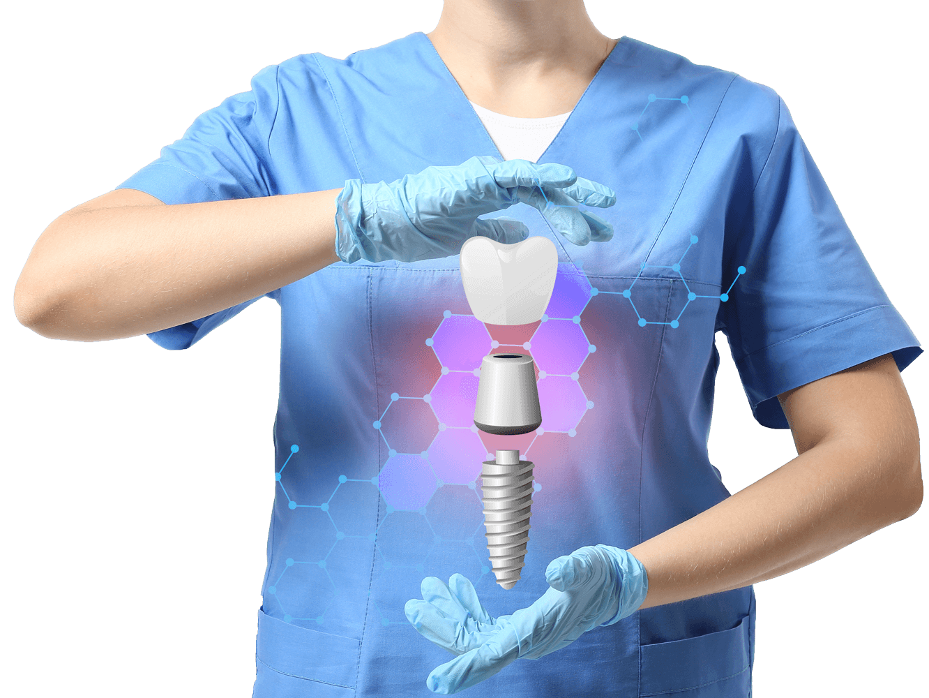 Titanium dental implants in mexico