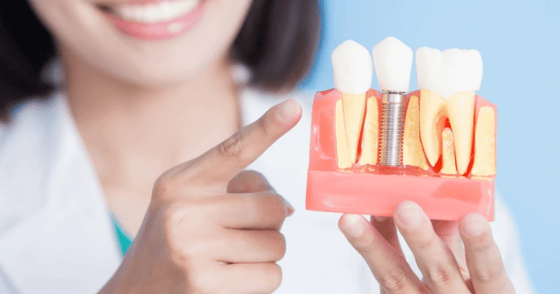 Our Cutting Edge Dental Implants